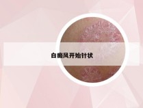 白癜风开始针状