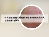 和有银屑病的人结婚怕不怕 和有银屑病的人结婚怕不怕怀孕