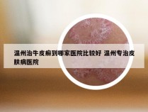 温州治牛皮癣到哪家医院比较好 温州专治皮肤病医院
