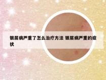银屑病严重了怎么治疗方法 银屑病严重的症状