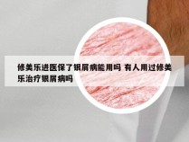 修美乐进医保了银屑病能用吗 有人用过修美乐治疗银屑病吗