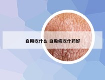 白殿吃什么 白殿病吃什药好