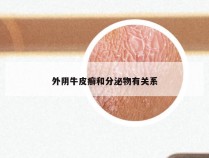 外阴牛皮癣和分泌物有关系