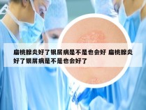 扁桃腺炎好了银屑病是不是也会好 扁桃腺炎好了银屑病是不是也会好了