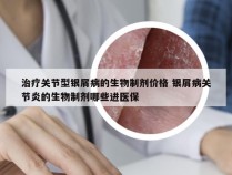 治疗关节型银屑病的生物制剂价格 银屑病关节炎的生物制剂哪些进医保