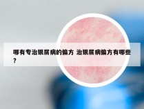 哪有专治银屑病的偏方 治银屑病偏方有哪些?