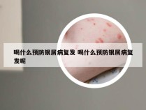 喝什么预防银屑病复发 喝什么预防银屑病复发呢