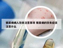 银屑病病人饮食注意事项 银屑病的饮食应该注意什么