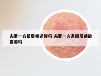 夫妻一方银屑病遗传吗 夫妻一方患银屑病能离婚吗