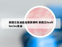新西兰鱼油能治银屑病吗 新西兰healtheries鱼油