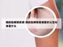 婚前隐瞒银屑病 婚前隐瞒银屑病罪的认定标准是什么