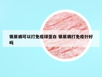 银屑病可以打免疫球蛋白 银屑病打免疫针好吗