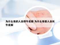 为什么有的人会得牛皮癣 为什么有些人会长牛皮癣