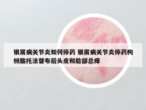 银屑病关节炎如何停药 银屑病关节炎停药枸橼酸托法替布后头皮和脸部总痒