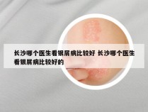 长沙哪个医生看银屑病比较好 长沙哪个医生看银屑病比较好的