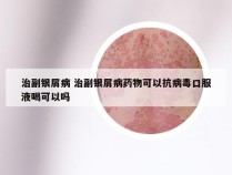 治副银屑病 治副银屑病药物可以抗病毒口服液喝可以吗