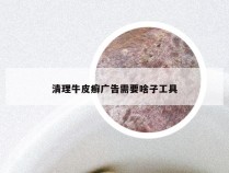 清理牛皮癣广告需要啥子工具