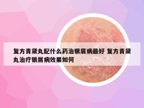 复方青黛丸配什么药治银屑病最好 复方青黛丸治疗银屑病效果如何