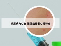 银屑病与心态 银屑病患者心理特点