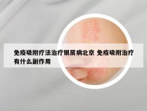 免疫吸附疗法治疗银屑病北京 免疫吸附治疗有什么副作用