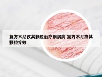 复方木尼孜其颗粒治疗银屑病 复方木尼孜其颗粒疗效
