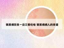 银屑病饮食一日三餐吃啥 银屑病病人的食谱