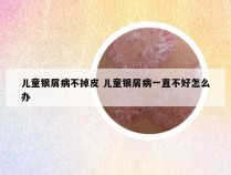 儿童银屑病不掉皮 儿童银屑病一直不好怎么办
