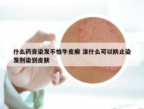 什么药膏染发不怕牛皮癣 涂什么可以防止染发剂染到皮肤