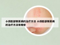 小孩脸部银屑病的治疗方法 小孩脸部银屑病的治疗方法有哪些