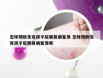 怎样预防生完孩子后银屑病复发 怎样预防生完孩子后银屑病复发呢