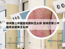 郑州第二中医院皮肤科怎么样 郑州市第二中医院去疤痕怎么样