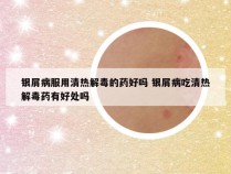 银屑病服用清热解毒的药好吗 银屑病吃清热解毒药有好处吗