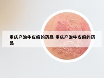 重庆产治牛皮癣的药品 重庆产治牛皮癣的药品