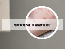 银屑病营养素 银屑病营养治疗