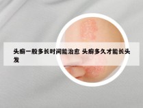 头癣一般多长时间能治愈 头癣多久才能长头发
