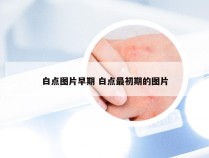 白点图片早期 白点最初期的图片