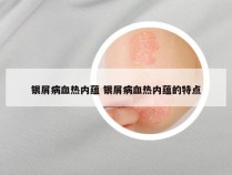 银屑病血热内蕴 银屑病血热内蕴的特点