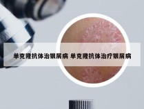 单克隆抗体治银屑病 单克隆抗体治疗银屑病