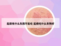 起藓有什么东西不能吃 起癣吃什么食物好