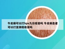 牛皮癣可以打hpv九价疫苗吗 牛皮癣患者可以打宫颈癌疫苗吗