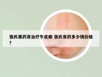 张氏黑药膏治疗牛皮癣 张氏膏药多少钱价格?