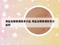 海盐治银屑病放多少盐 海盐治银屑病放多少盐好