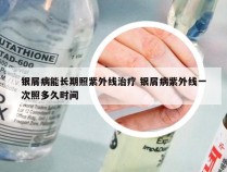 银屑病能长期照紫外线治疗 银屑病紫外线一次照多久时间