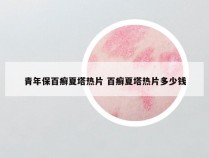 青年保百癣夏塔热片 百癣夏塔热片多少钱