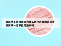 银屑病不能用激素为什么医院还开激素药膏 银屑病一定不能用激素吗