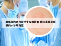 廊坊哪所医院治疗牛皮癣最好 廊坊市看皮肤病的小诊所电话