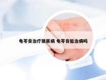 龟苓膏治疗银屑病 龟苓膏能治病吗