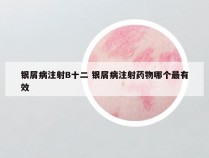 银屑病注射B十二 银屑病注射药物哪个最有效