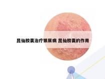 昆仙胶囊治疗银屑病 昆仙胶囊的作用