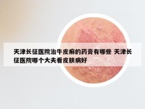 天津长征医院治牛皮癣的药膏有哪些 天津长征医院哪个大夫看皮肤病好